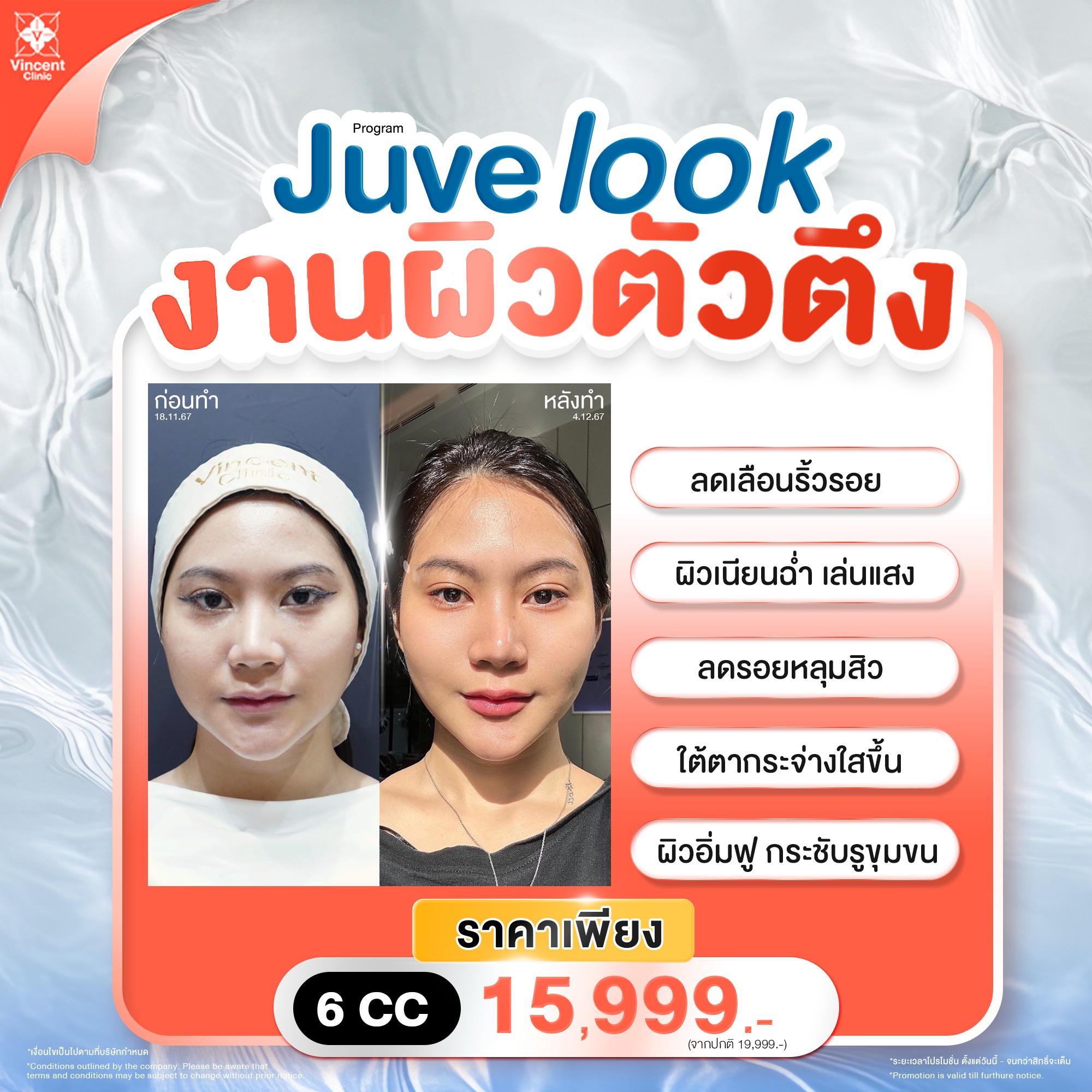 Juvelook
